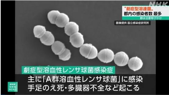 致死30%的“食人菌”蔓延日本，确诊近千例！日本是否能够应对此菌？旅日游客该作何