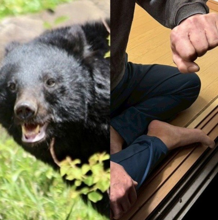 日本熊袭事件创历史新高：196人受害13人死亡 