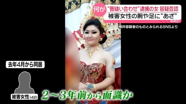 日本变态女子缝合室友双唇，竟是为了…？！电锯惊魂竟然在现实上演…